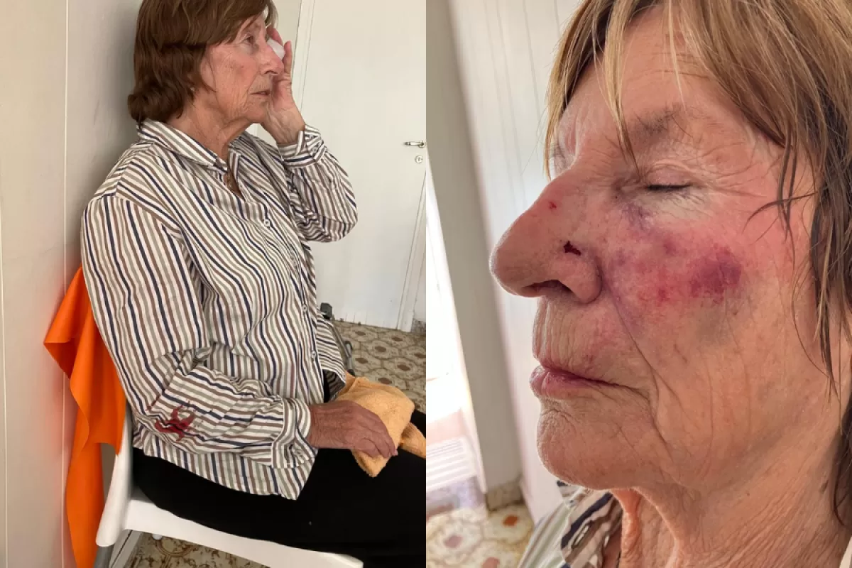 Violento episodio en Mar del Plata: una mujer mayor perdió dientes tras ser golpeada por ladrones