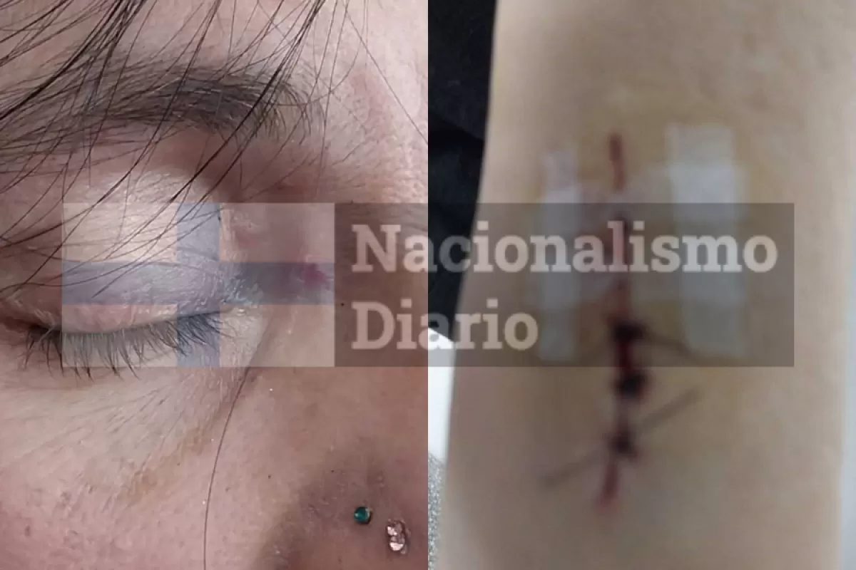 Escándalo en Tigre por denuncia de agresión contra una referente de La Libertad Avanza