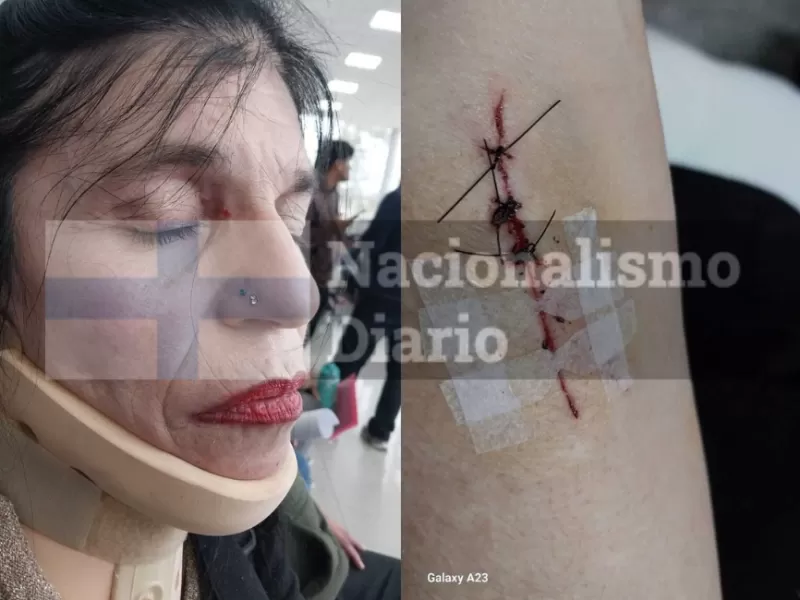 Escándalo en Tigre por denuncia de agresión contra una referente de La Libertad Avanza