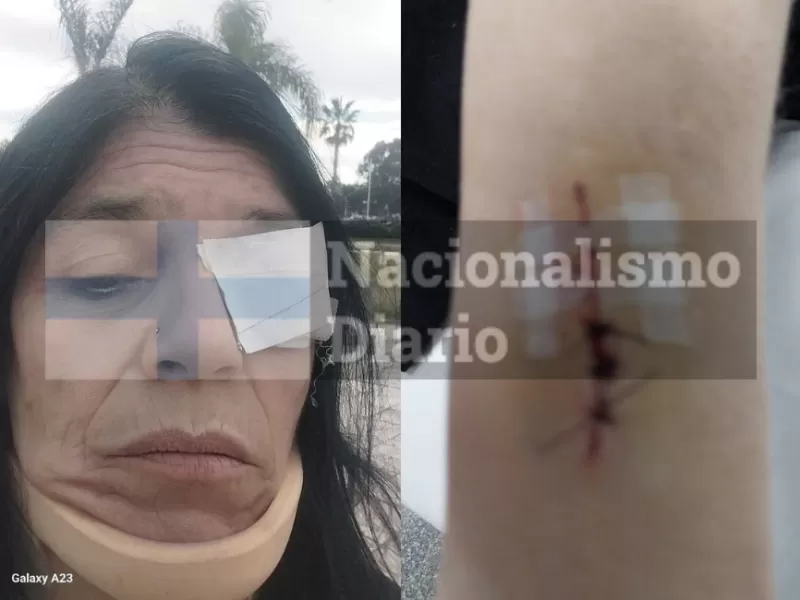 Escándalo en Tigre por denuncia de agresión contra una referente de La Libertad Avanza
