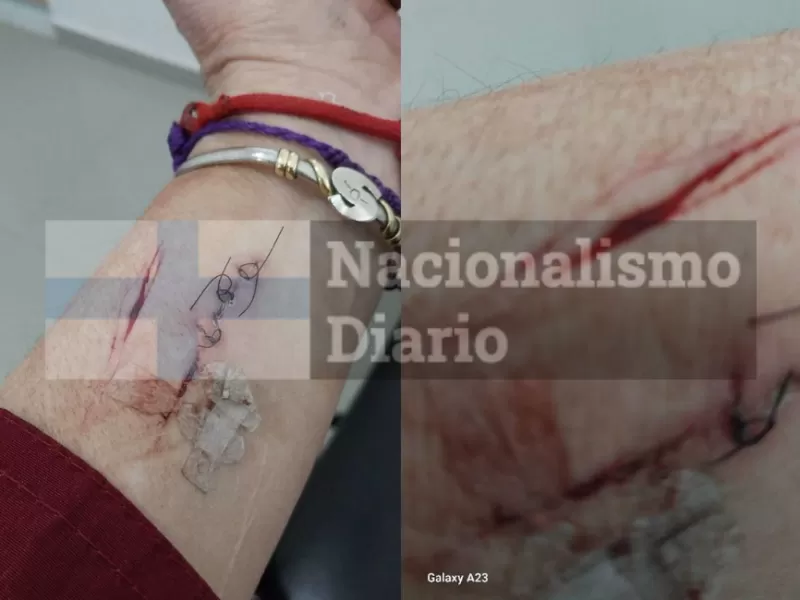 Escándalo en Tigre por denuncia de agresión contra una referente de La Libertad Avanza