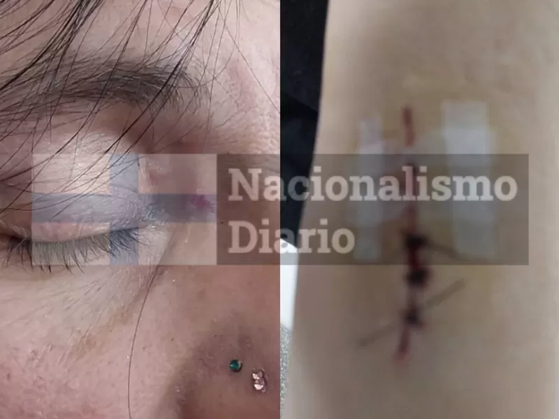 Escándalo en Tigre por denuncia de agresión contra una referente de La Libertad Avanza